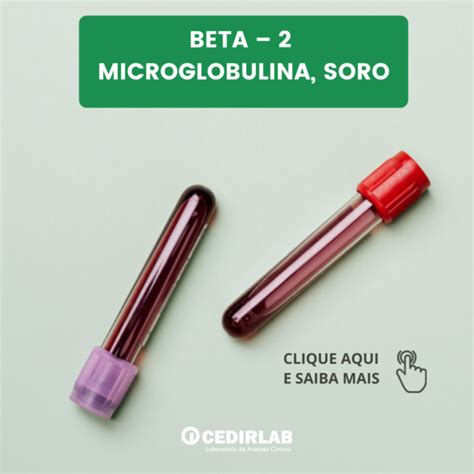 beta 2 microglobulina no soro